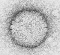 Aujesky_Virus.jpg