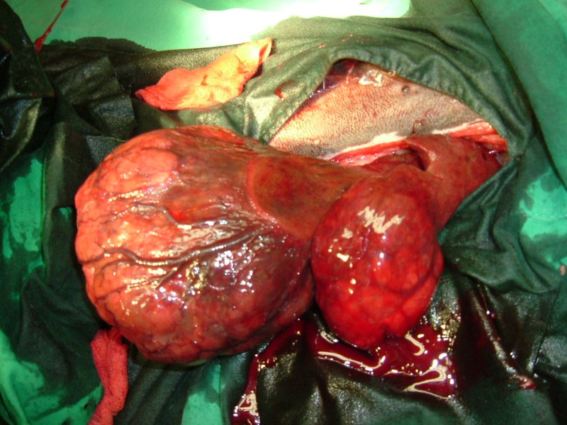  Milztumor bei einem Hund Milztumor bei einem Hund